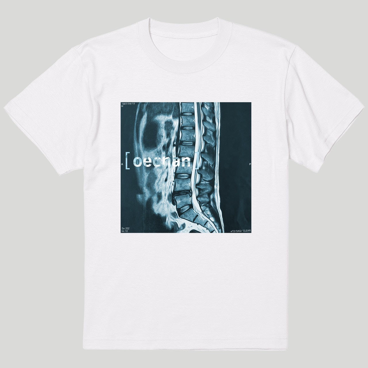 レントゲンTシャツ